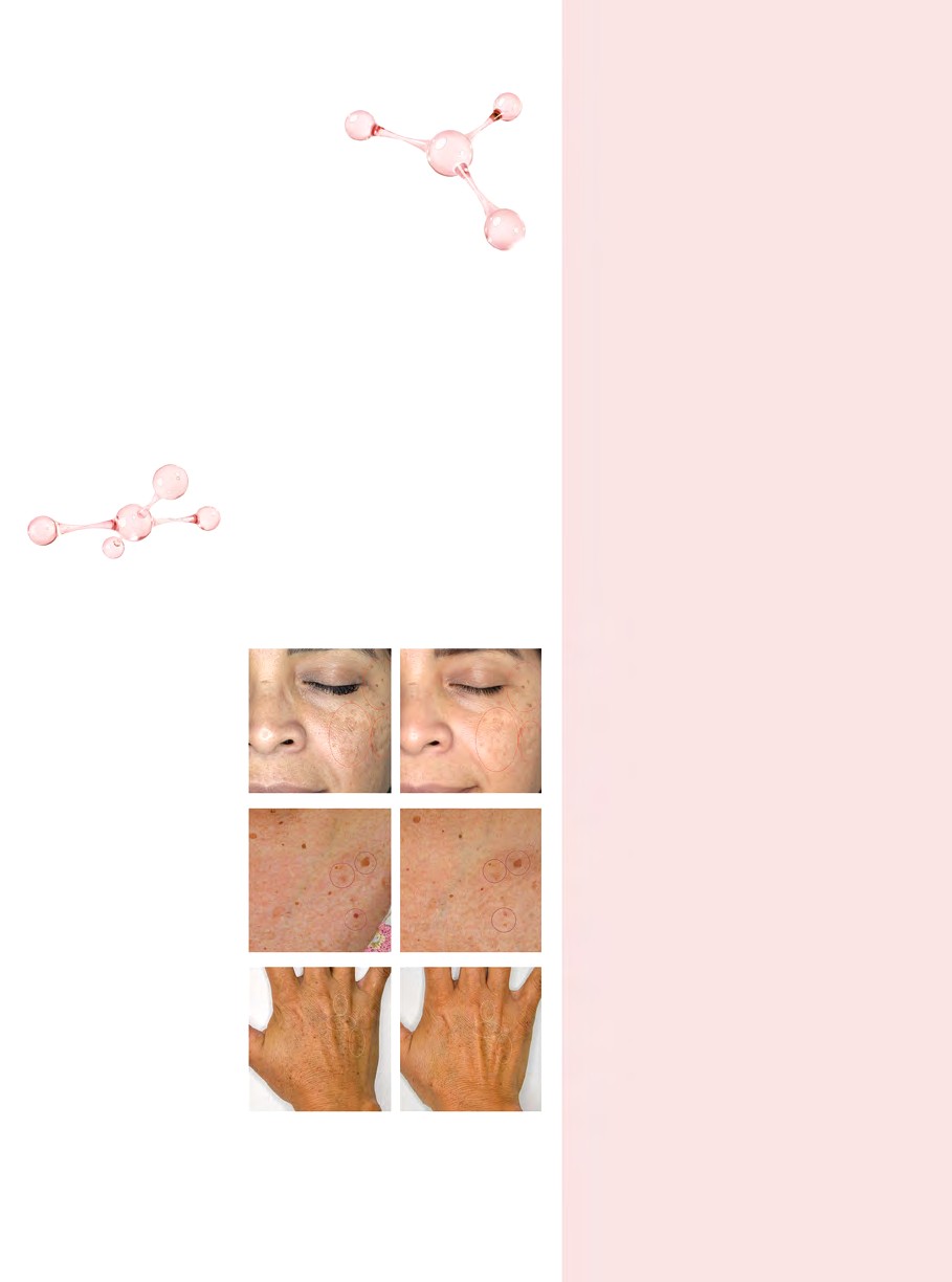 Espuma de Limpieza Facial (Luminous-Specialist)